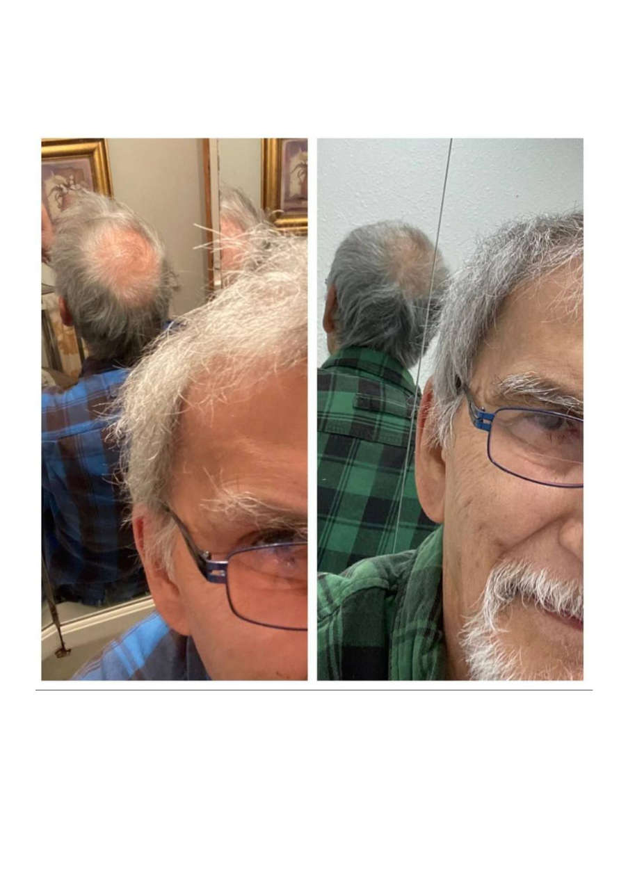 Strona 10 – Fototerapia Ogrody Spa