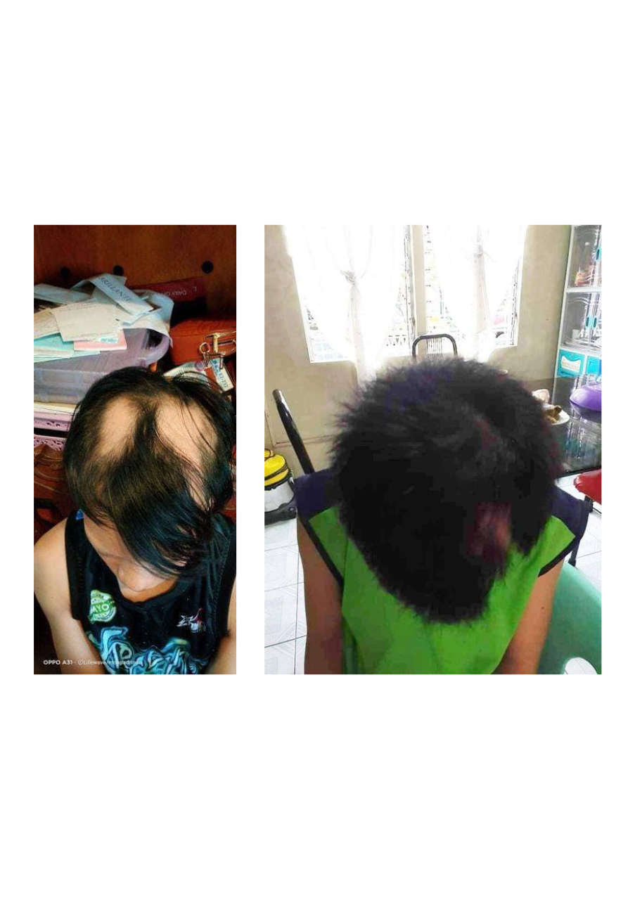 Strona 2 – Fototerapia Ogrody Spa