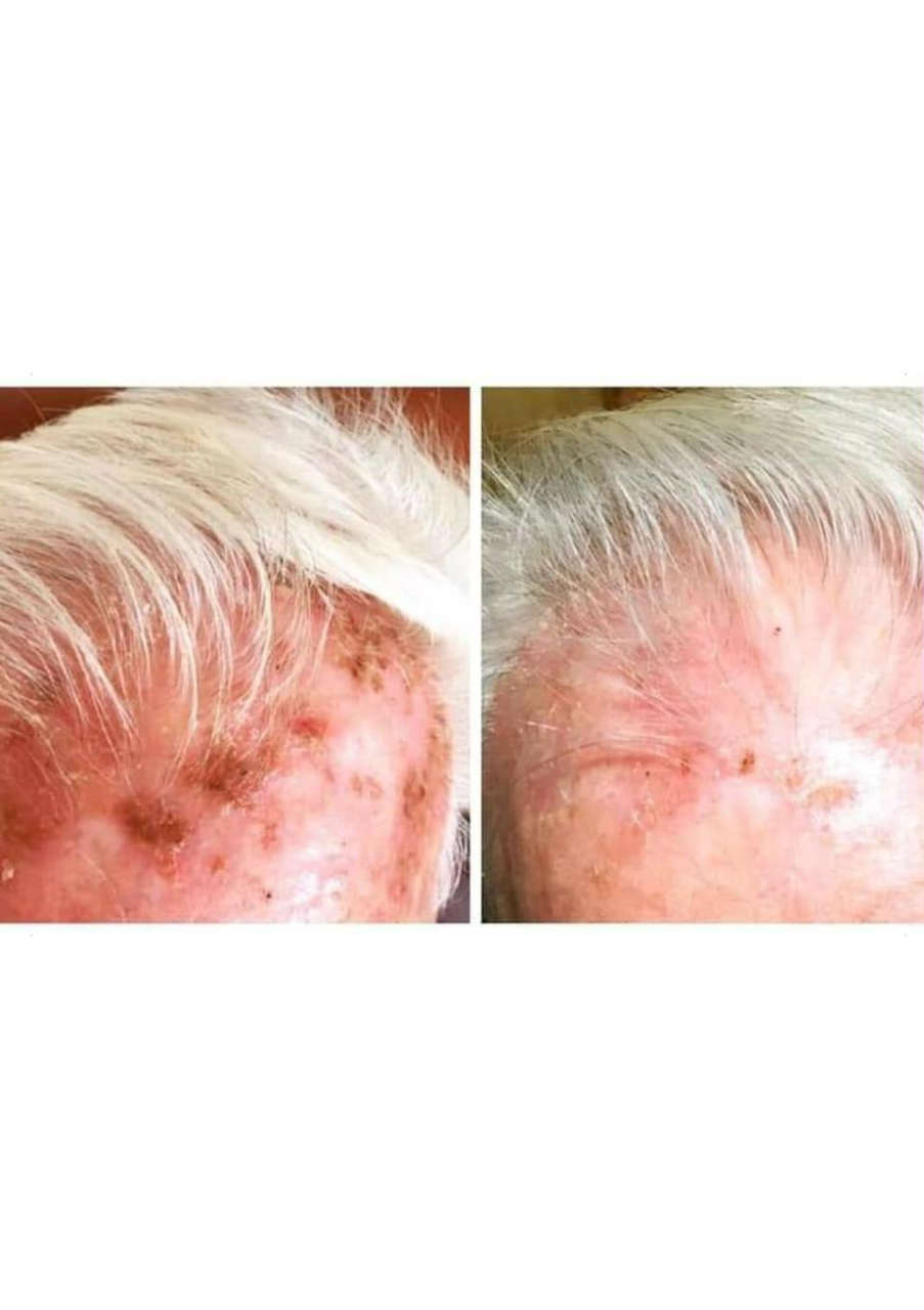 Strona 3 – Fototerapia Ogrody Spa