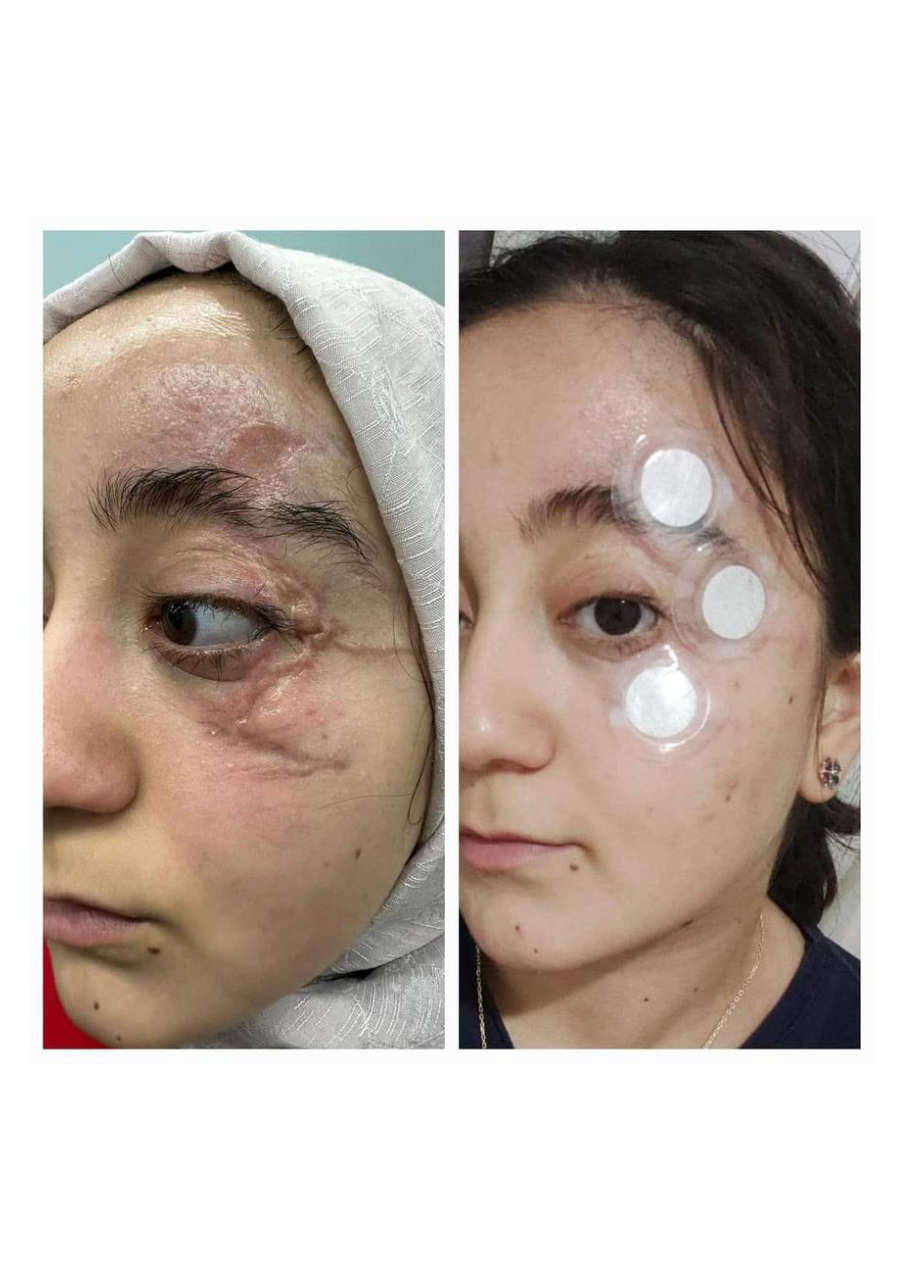 Strona 1 – Fototerapia Ogrody Spa