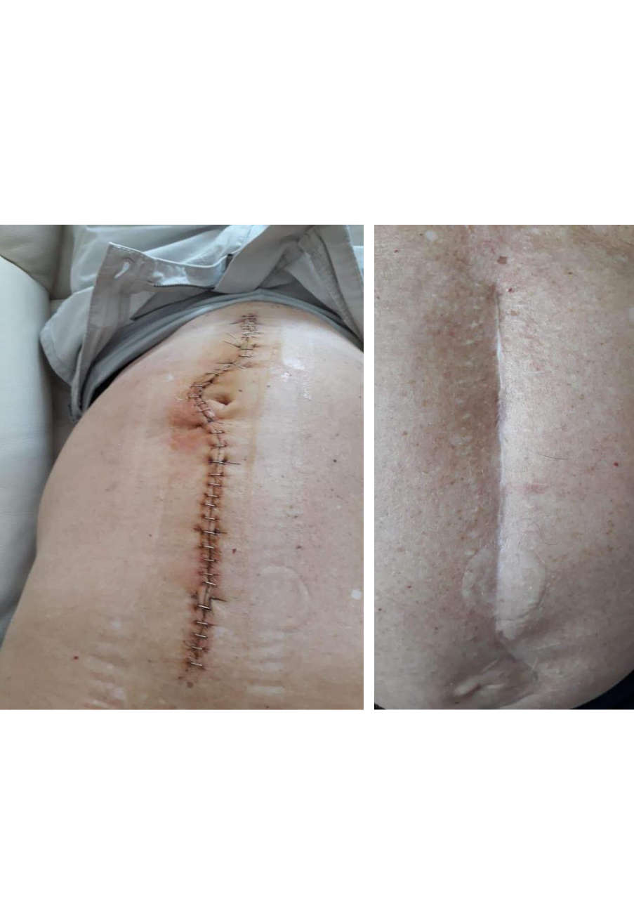 Strona 3 – Fototerapia Ogrody Spa