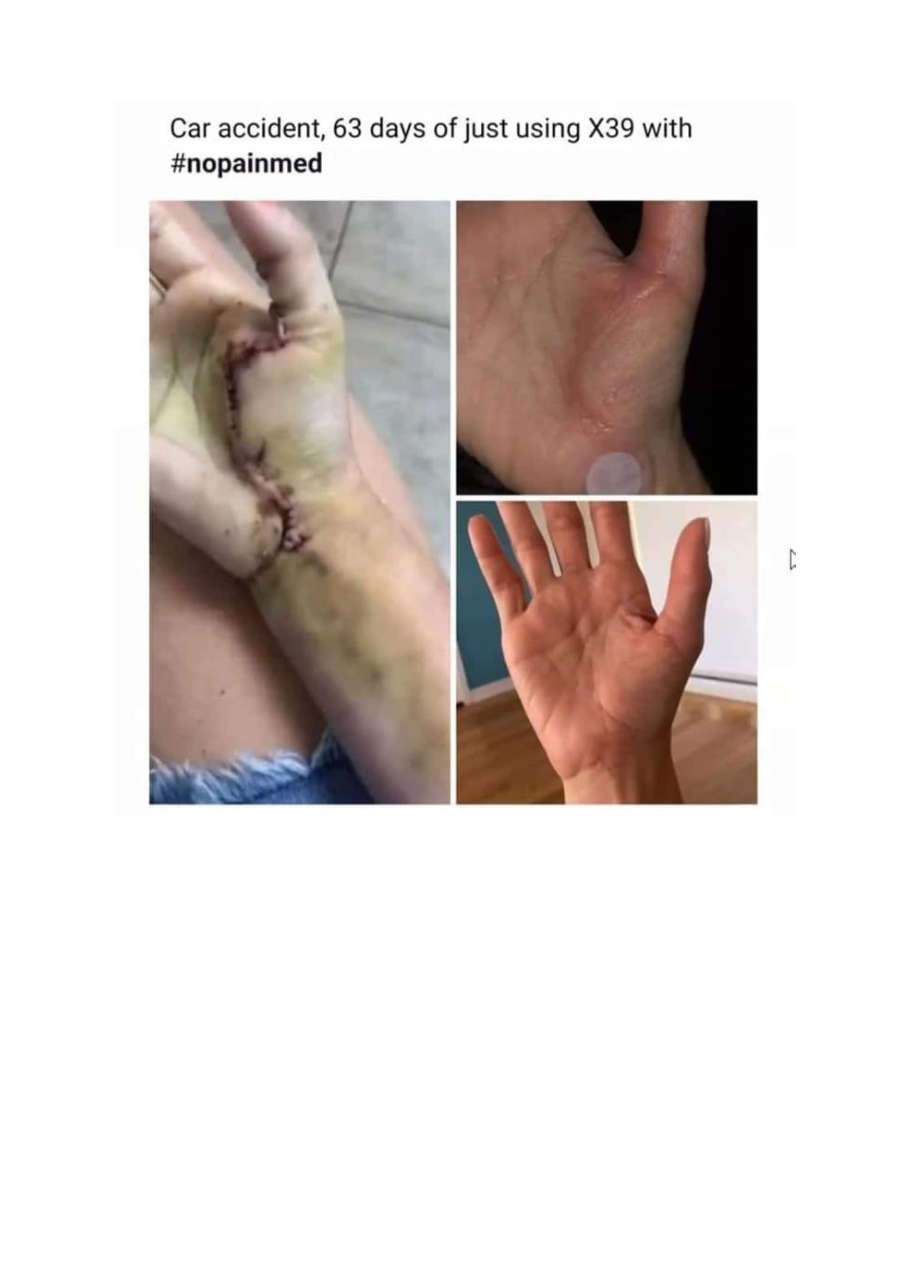 Strona 5 – Fototerapia Ogrody Spa