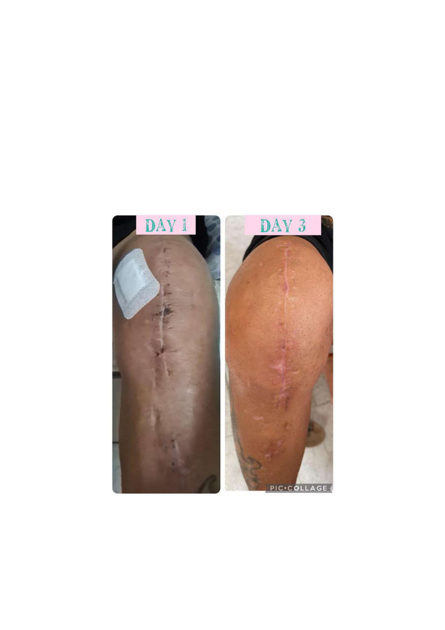 Strona 2 – Fototerapia Ogrody Spa