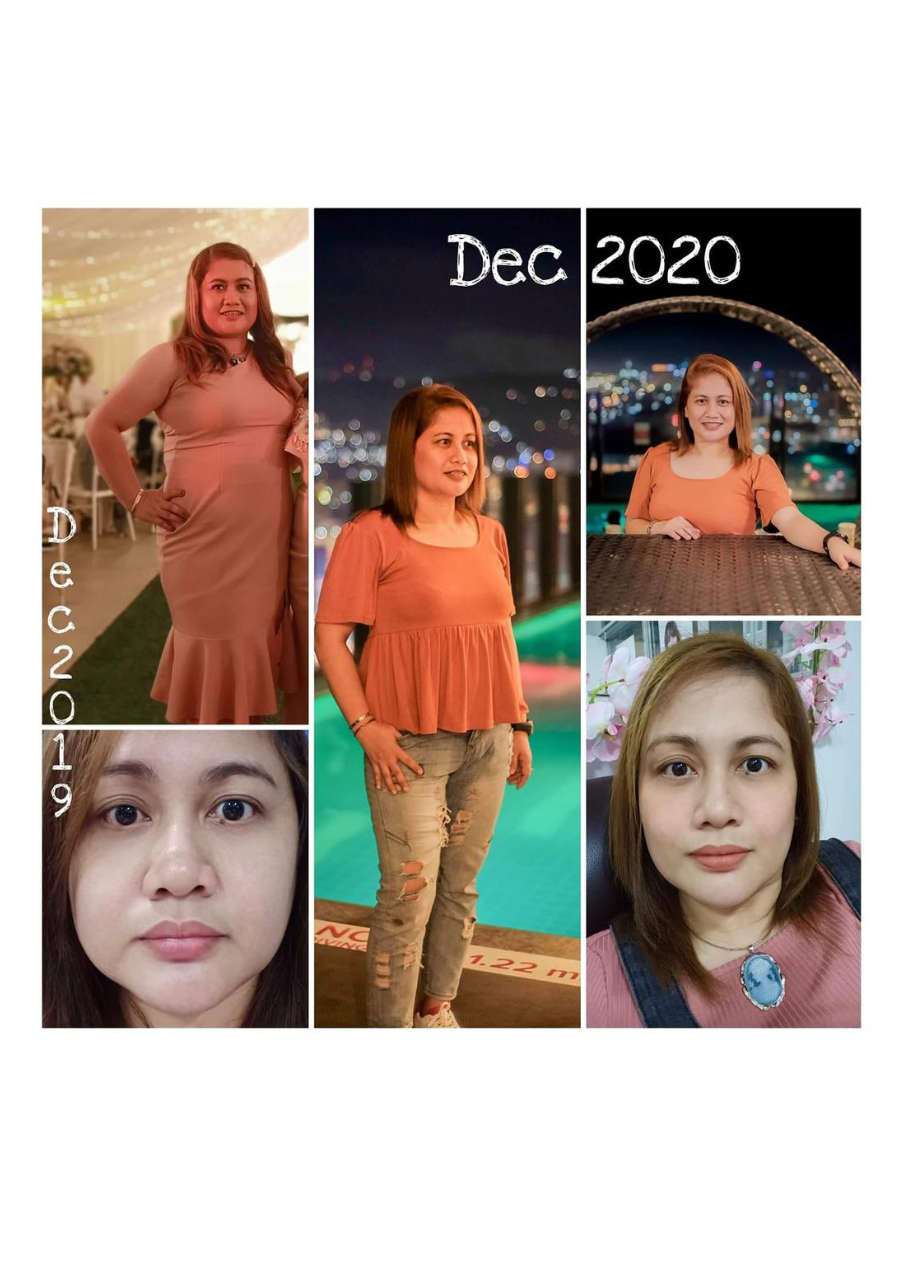 Strona 4 – Fototerapia Ogrody Spa