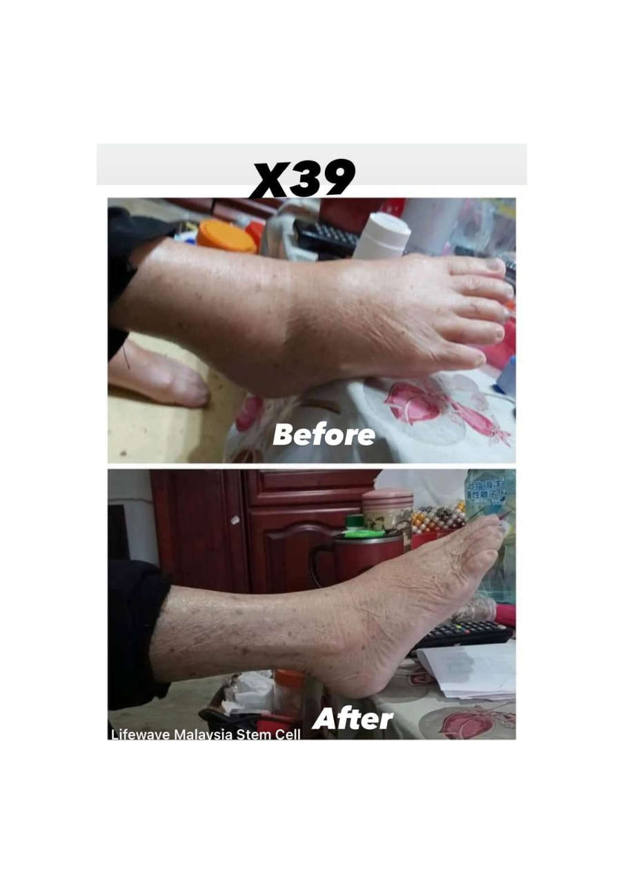 Strona 10 – Fototerapia Ogrody Spa