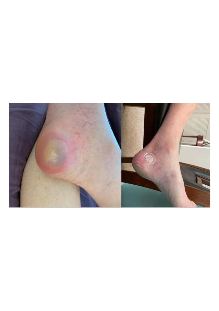 Strona 1 – Fototerapia Ogrody Spa