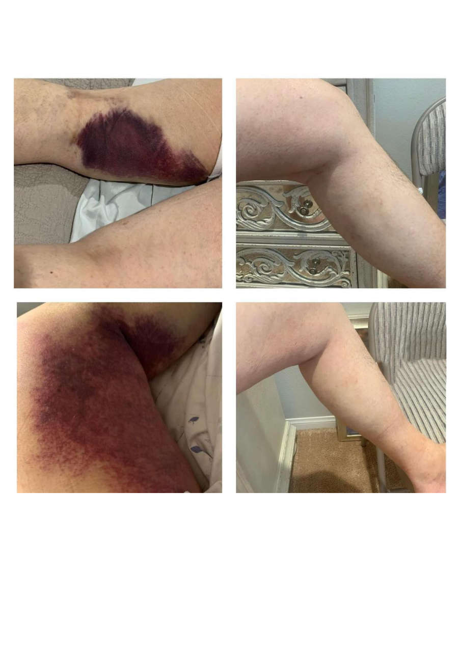 Strona 3 – Fototerapia Ogrody Spa