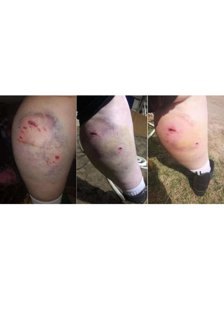 Strona 6 – Fototerapia Ogrody Spa