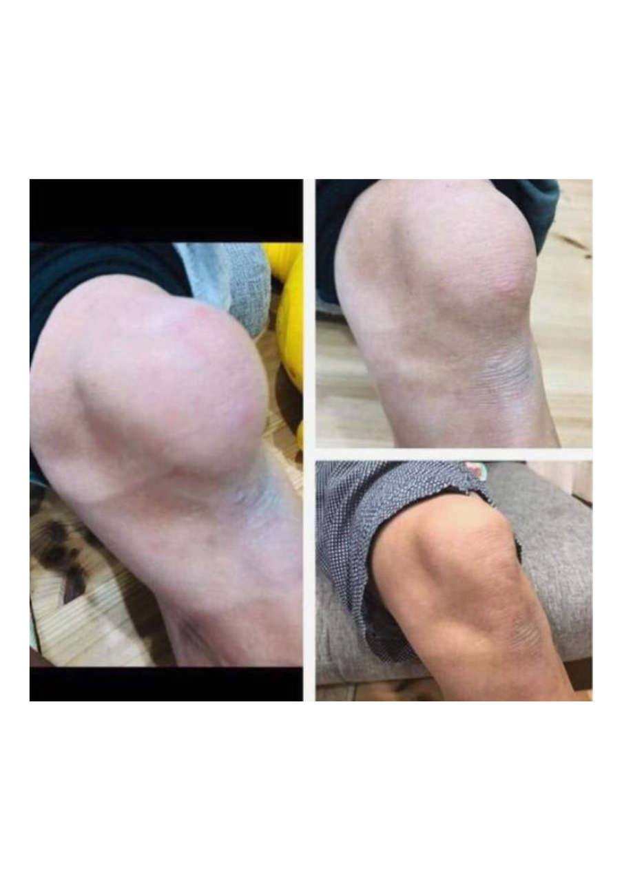 Strona 8 – Fototerapia Ogrody Spa