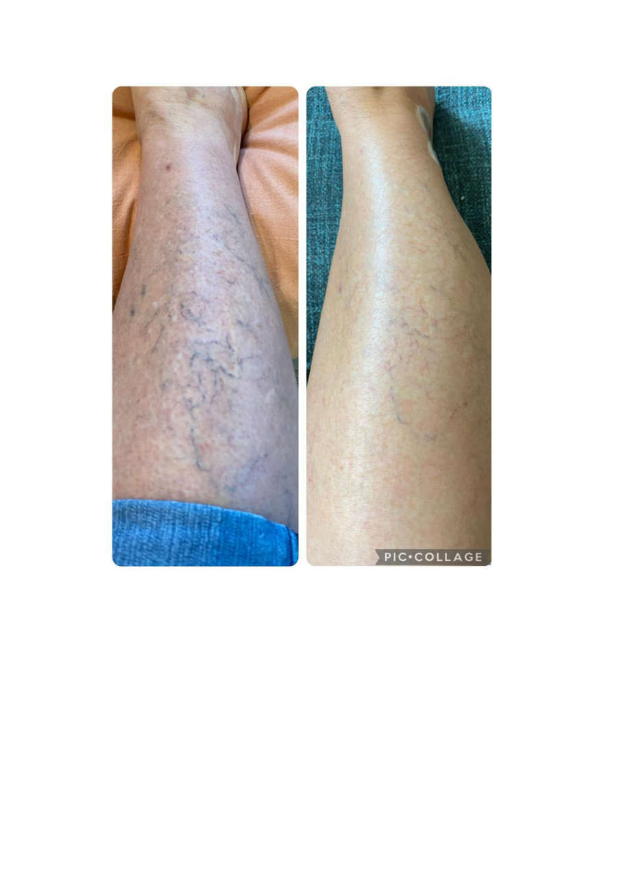 Strona 1 – Fototerapia Ogrody Spa