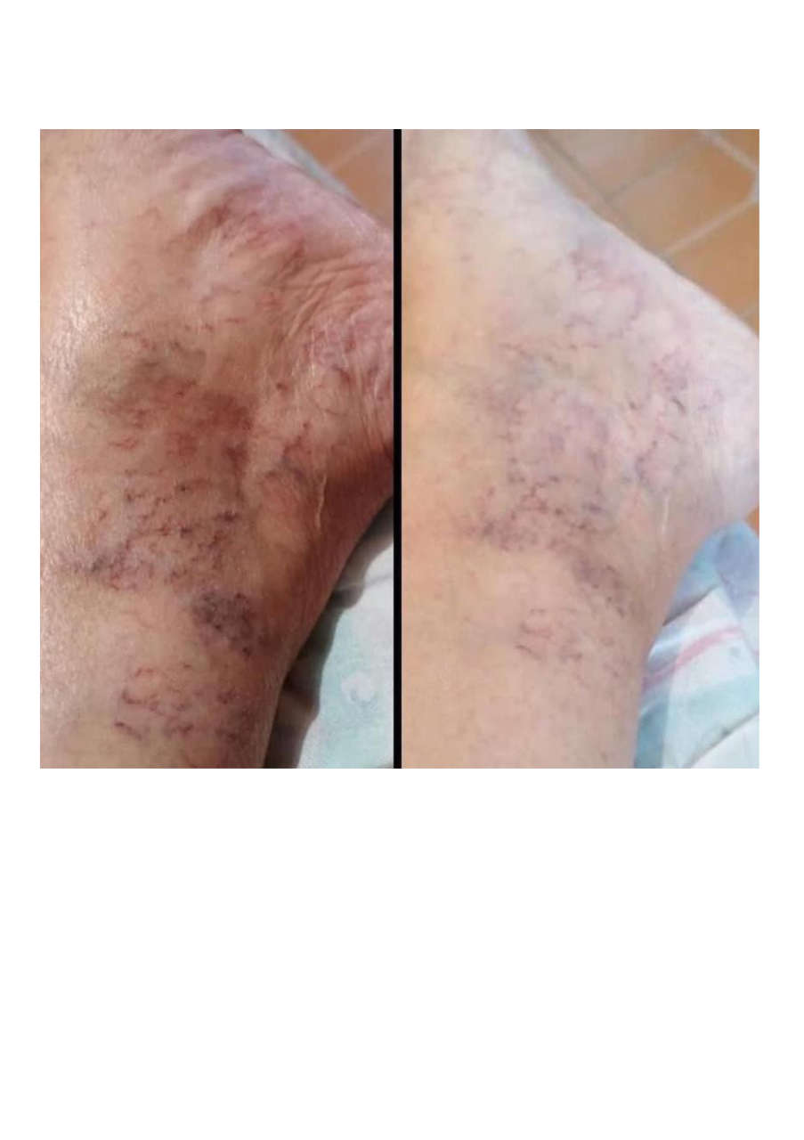 Strona 3 – Fototerapia Ogrody Spa