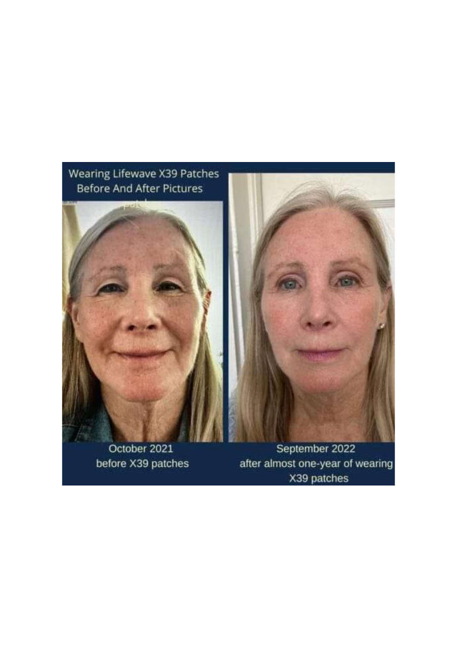 Strona 6 – Fototerapia Ogrody Spa