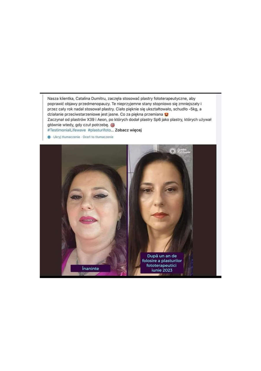 Strona 10 – Fototerapia Ogrody Spa