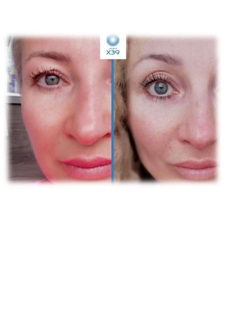 Strona 3 – Fototerapia Ogrody Spa