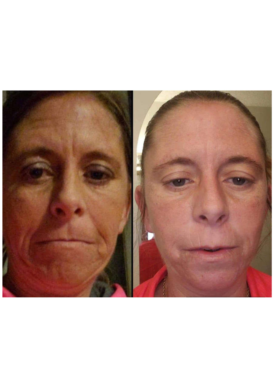 Strona 4 – Fototerapia Ogrody Spa