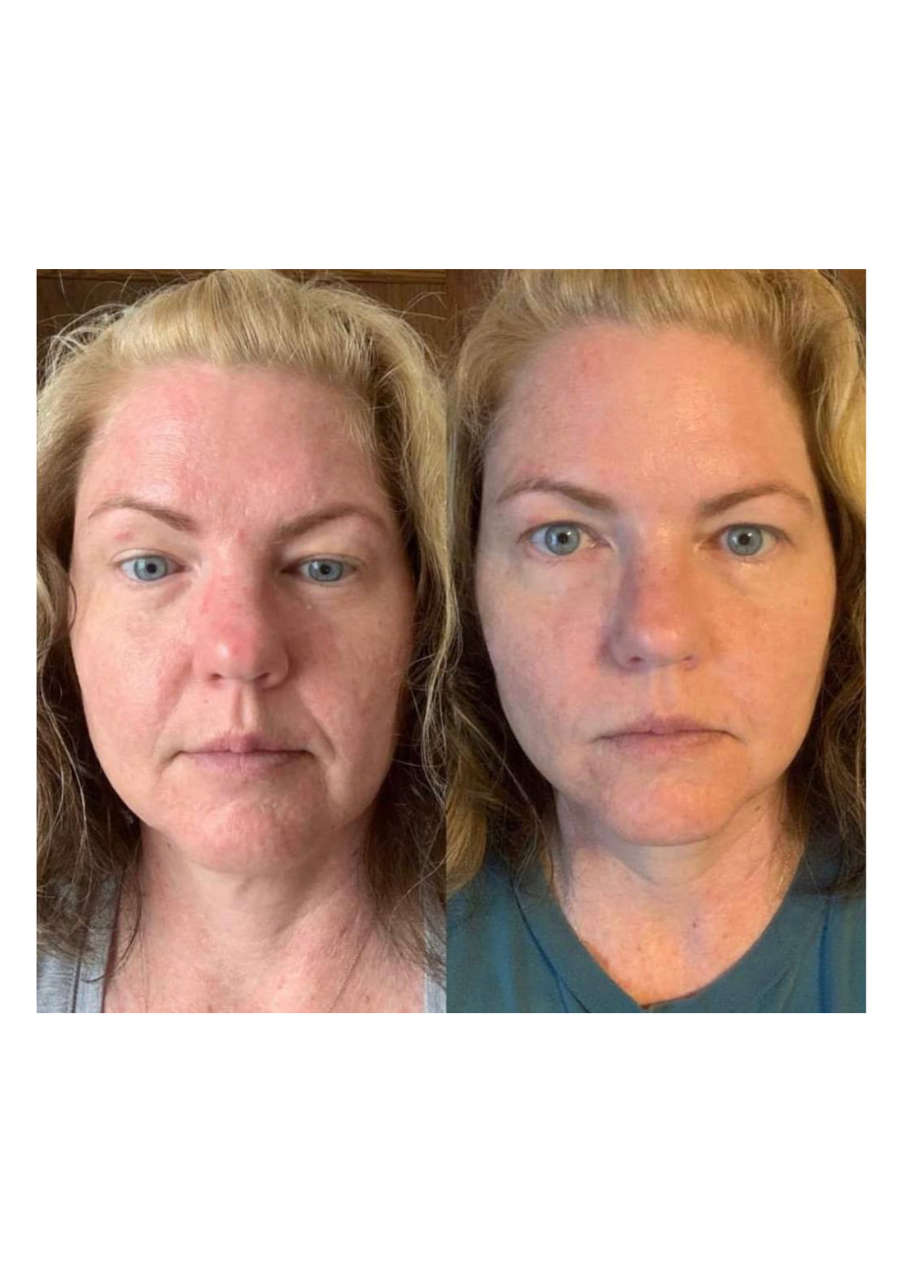 Strona 8 – Fototerapia Ogrody Spa