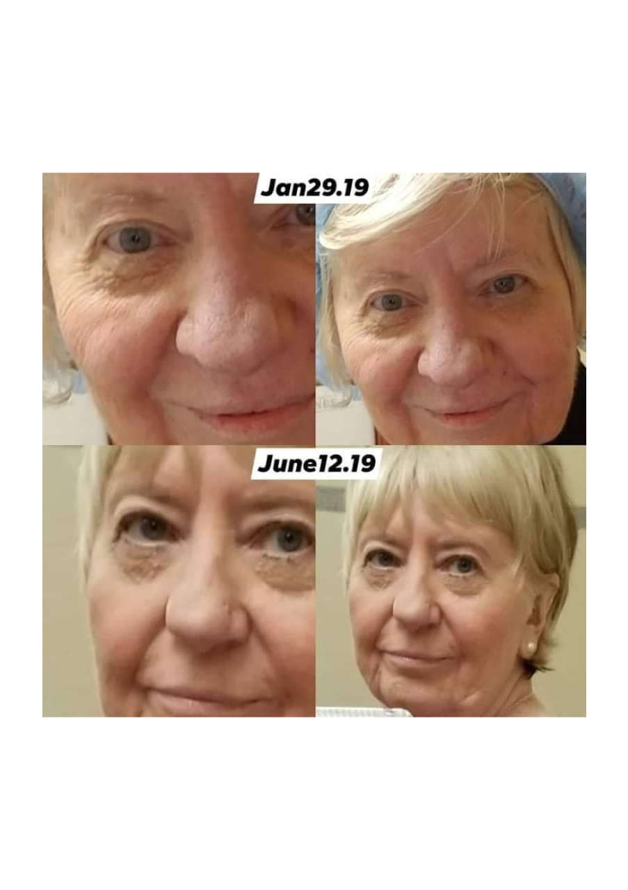 Strona 10 – Fototerapia Ogrody Spa