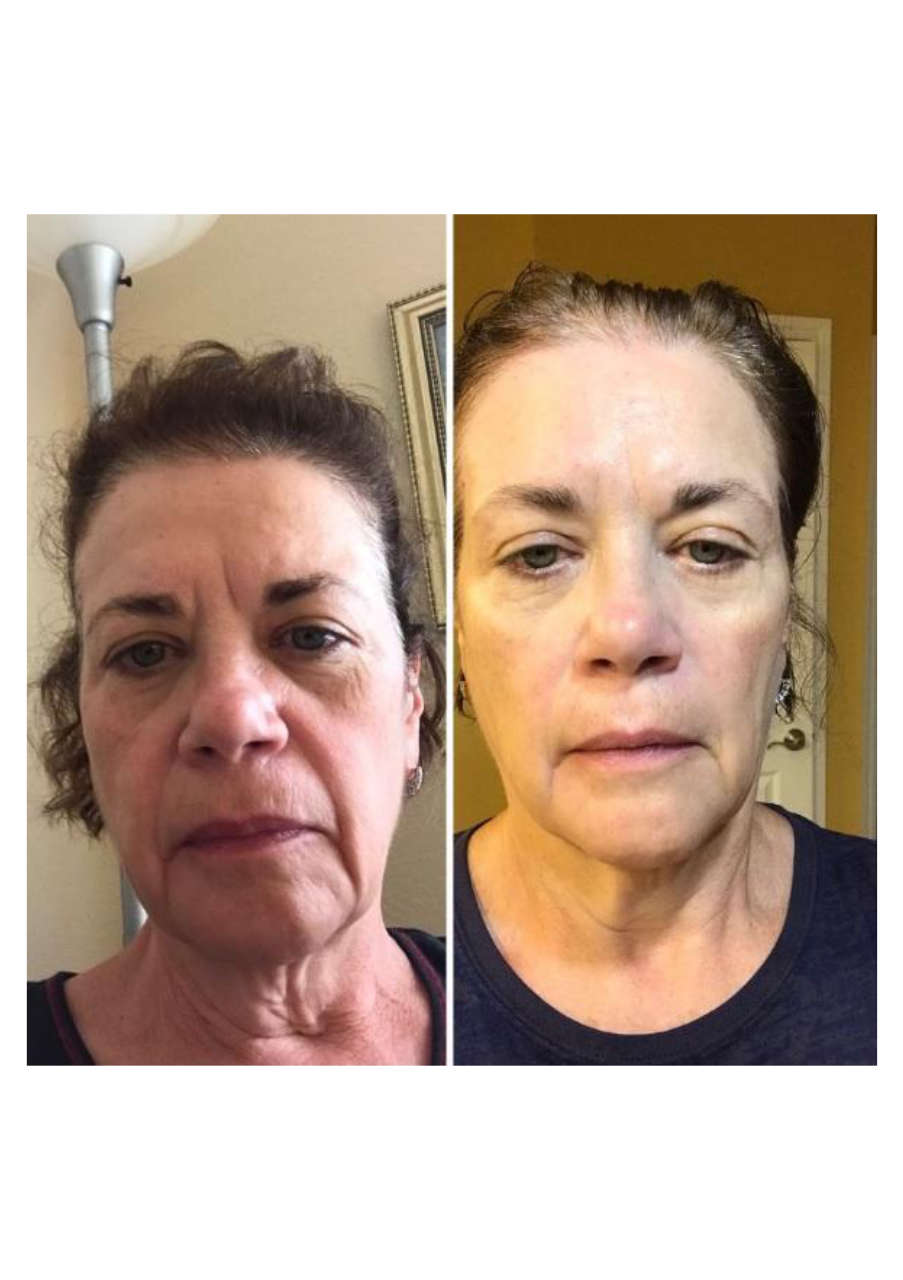 Strona 1 – Fototerapia Ogrody Spa