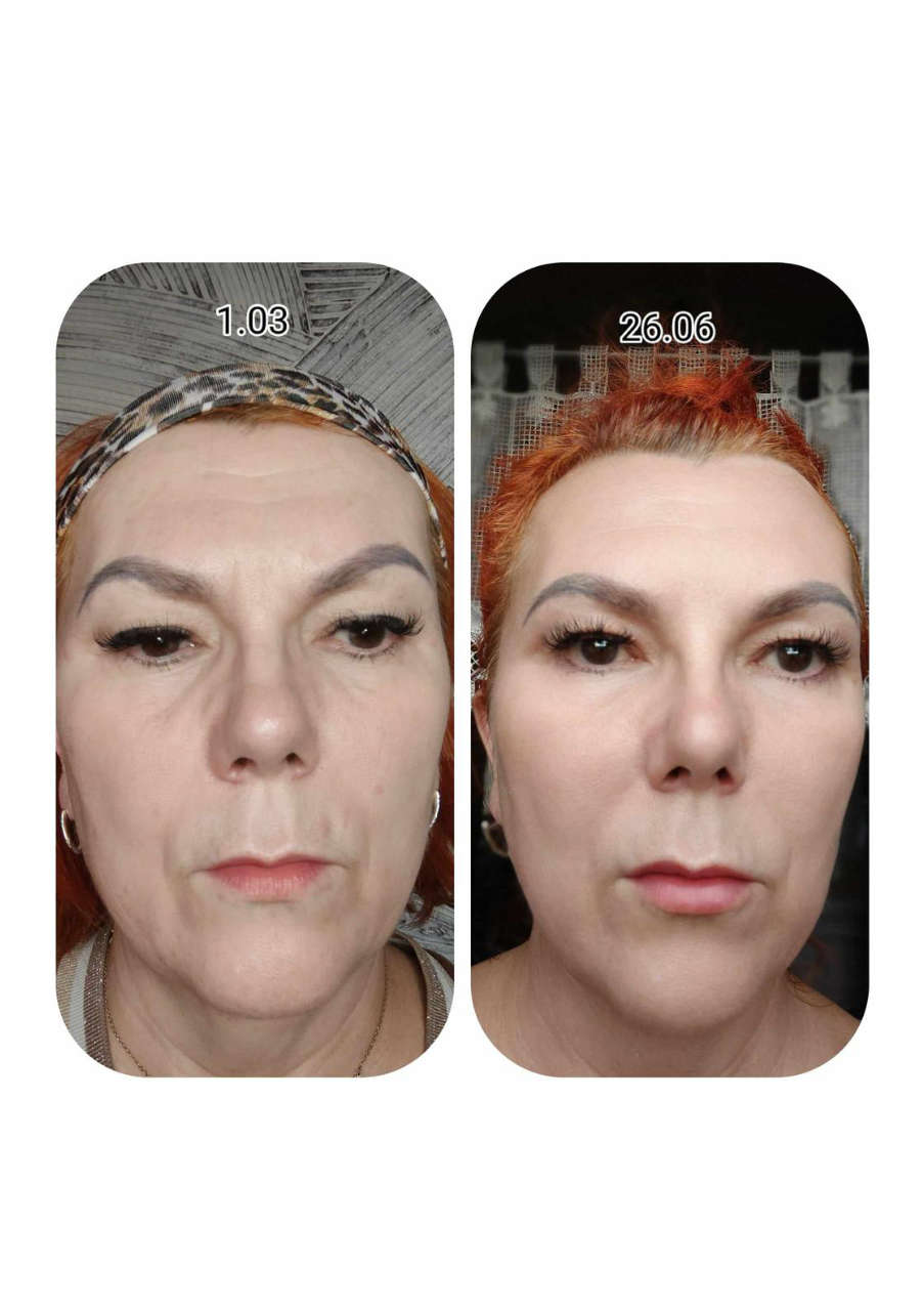 Strona 3 – Fototerapia Ogrody Spa