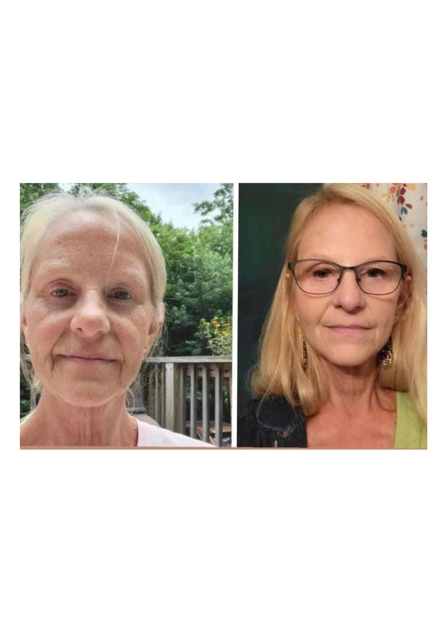 Strona 5 – Fototerapia Ogrody Spa