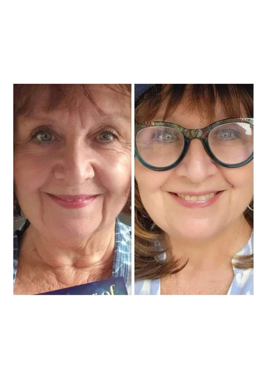 Strona 6 – Fototerapia Ogrody Spa