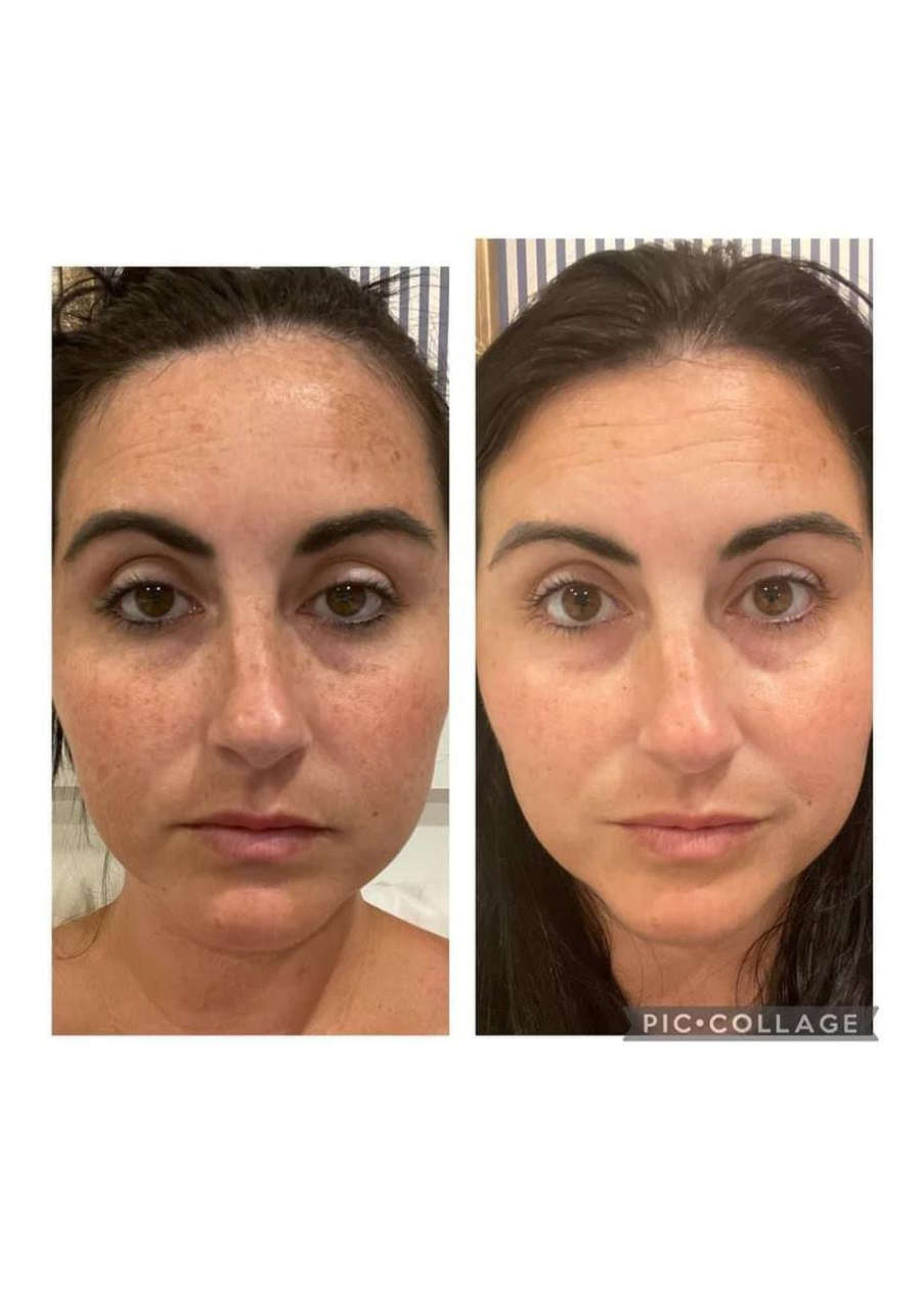 Strona 7 – Fototerapia Ogrody Spa