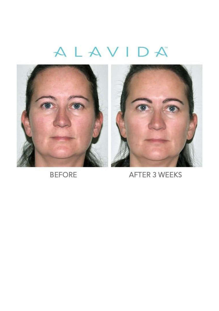 Strona 3 – Fototerapia Ogrody Spa