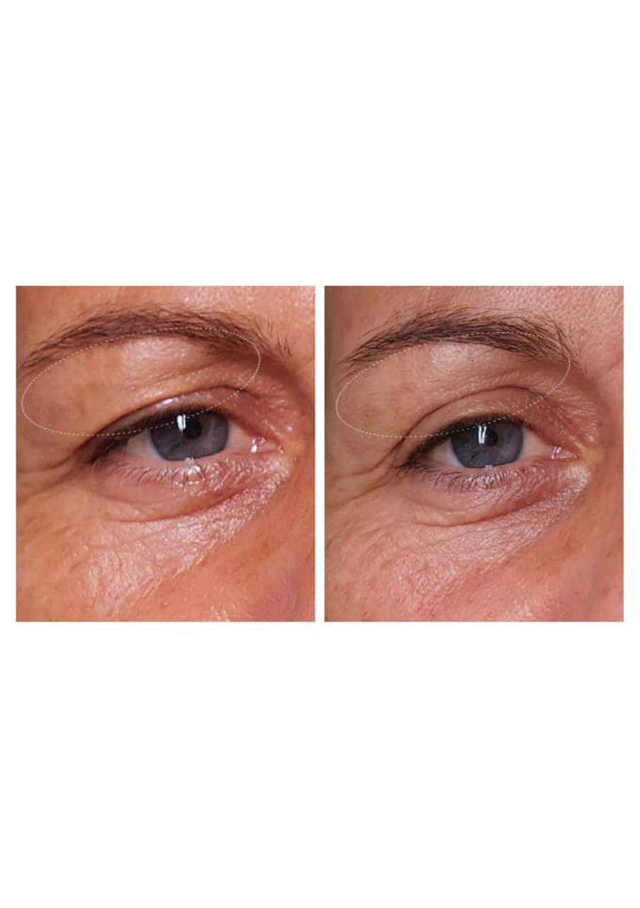 Strona 4 – Fototerapia Ogrody Spa