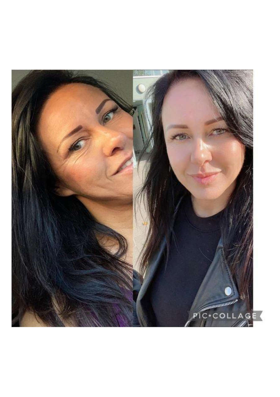 Strona 5 – Fototerapia Ogrody Spa