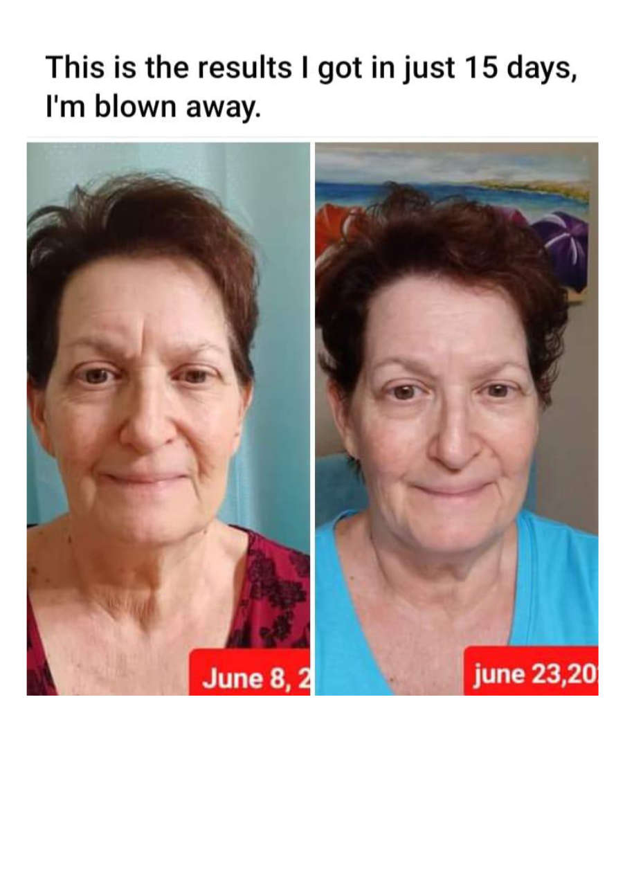 Strona 9 – Fototerapia Ogrody Spa