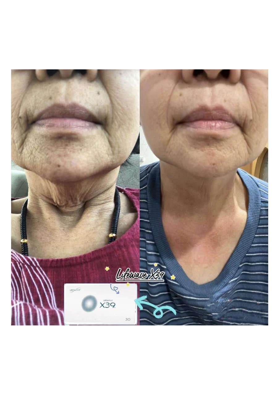 Strona 1 – Fototerapia Ogrody Spa