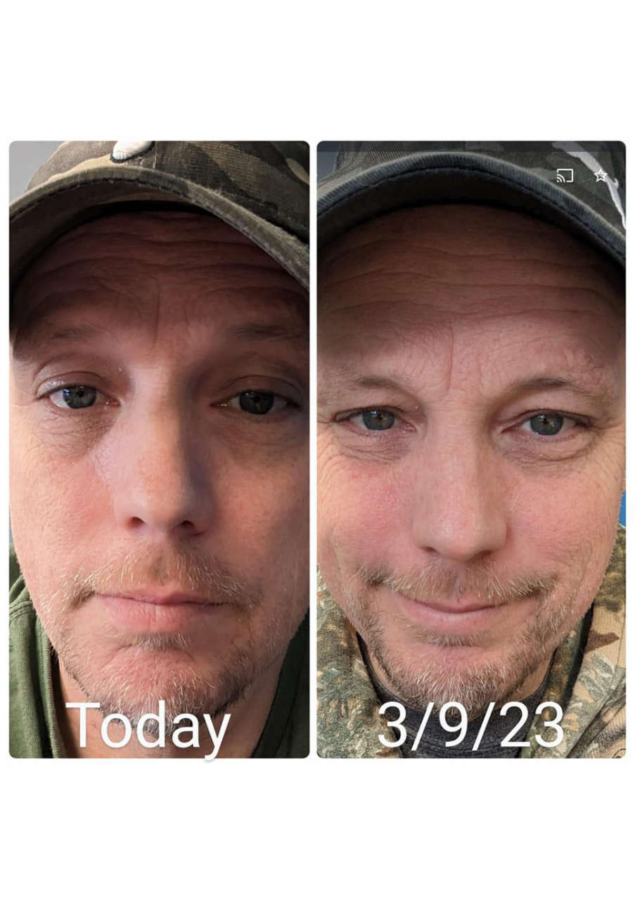 Strona 3 – Fototerapia Ogrody Spa