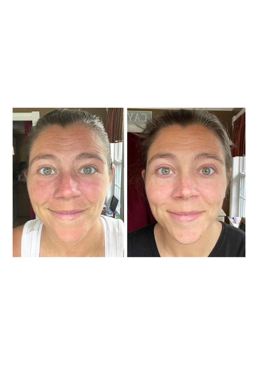 Strona 4 – Fototerapia Ogrody Spa