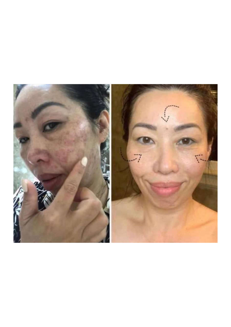 Strona 5 – Fototerapia Ogrody Spa