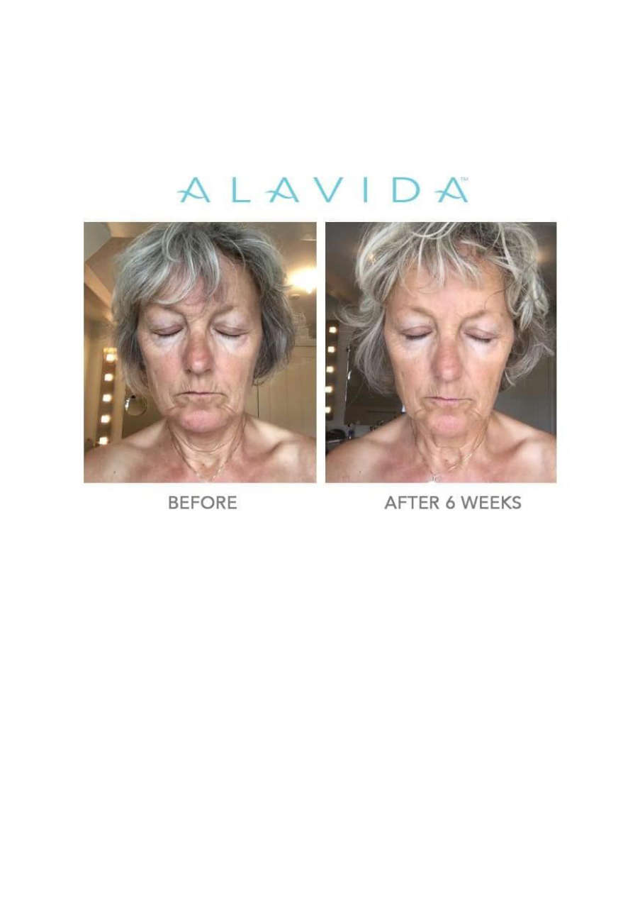 Strona 6 – Fototerapia Ogrody Spa