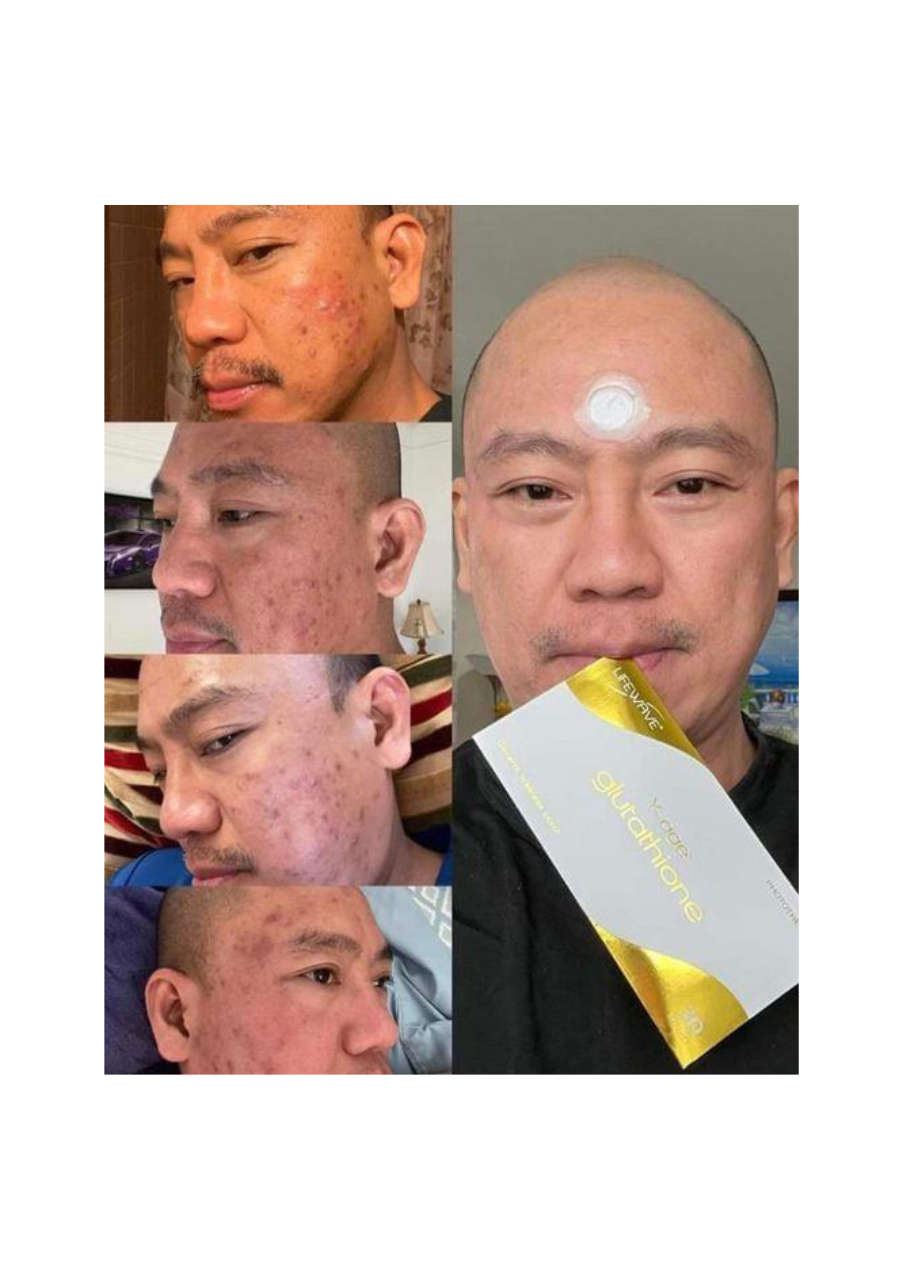 Strona 7 – Fototerapia Ogrody Spa