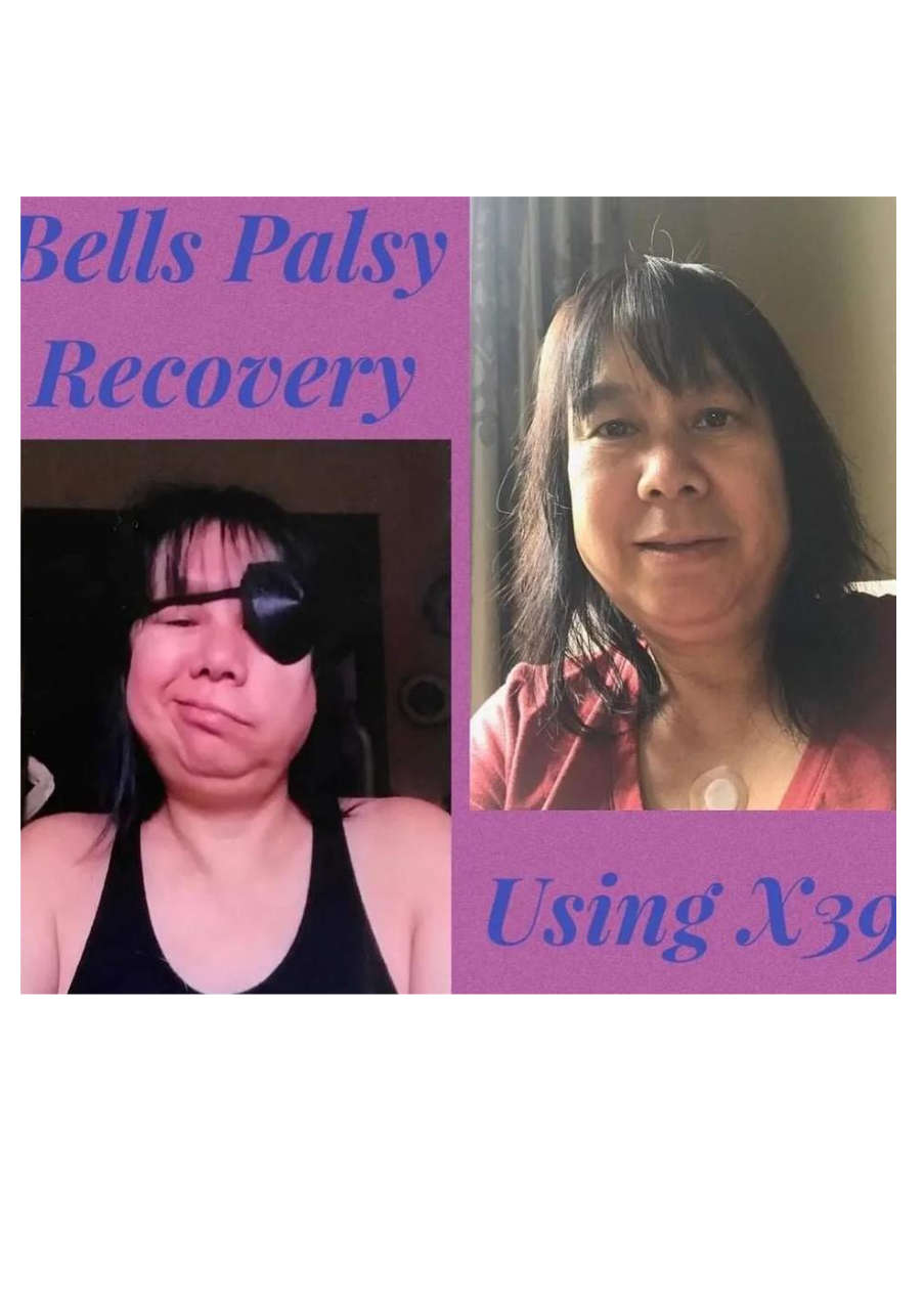 Strona 2 – Fototerapia Ogrody Spa