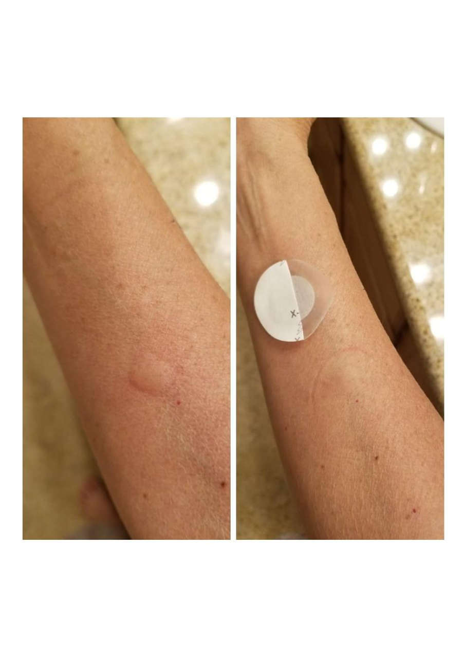 Strona 3 – Fototerapia Ogrody Spa