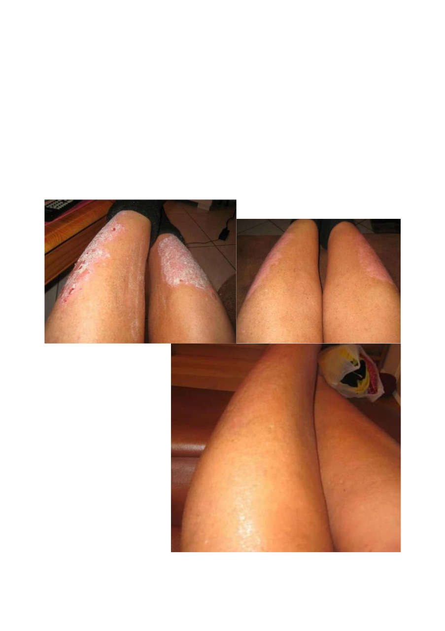 Strona 4 – Fototerapia Ogrody Spa