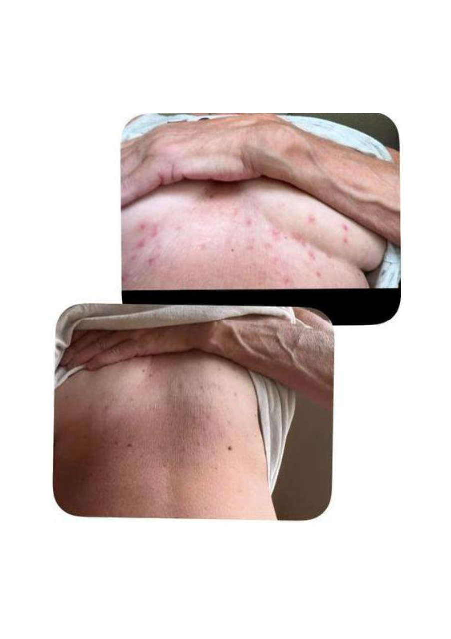 Strona 7 – Fototerapia Ogrody Spa