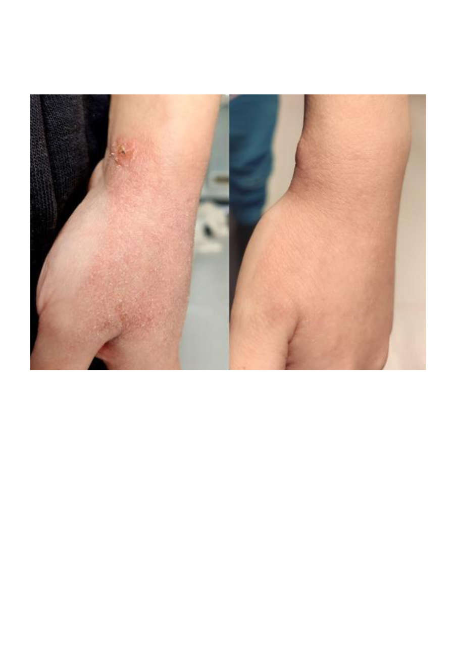 Strona 9 – Fototerapia Ogrody Spa