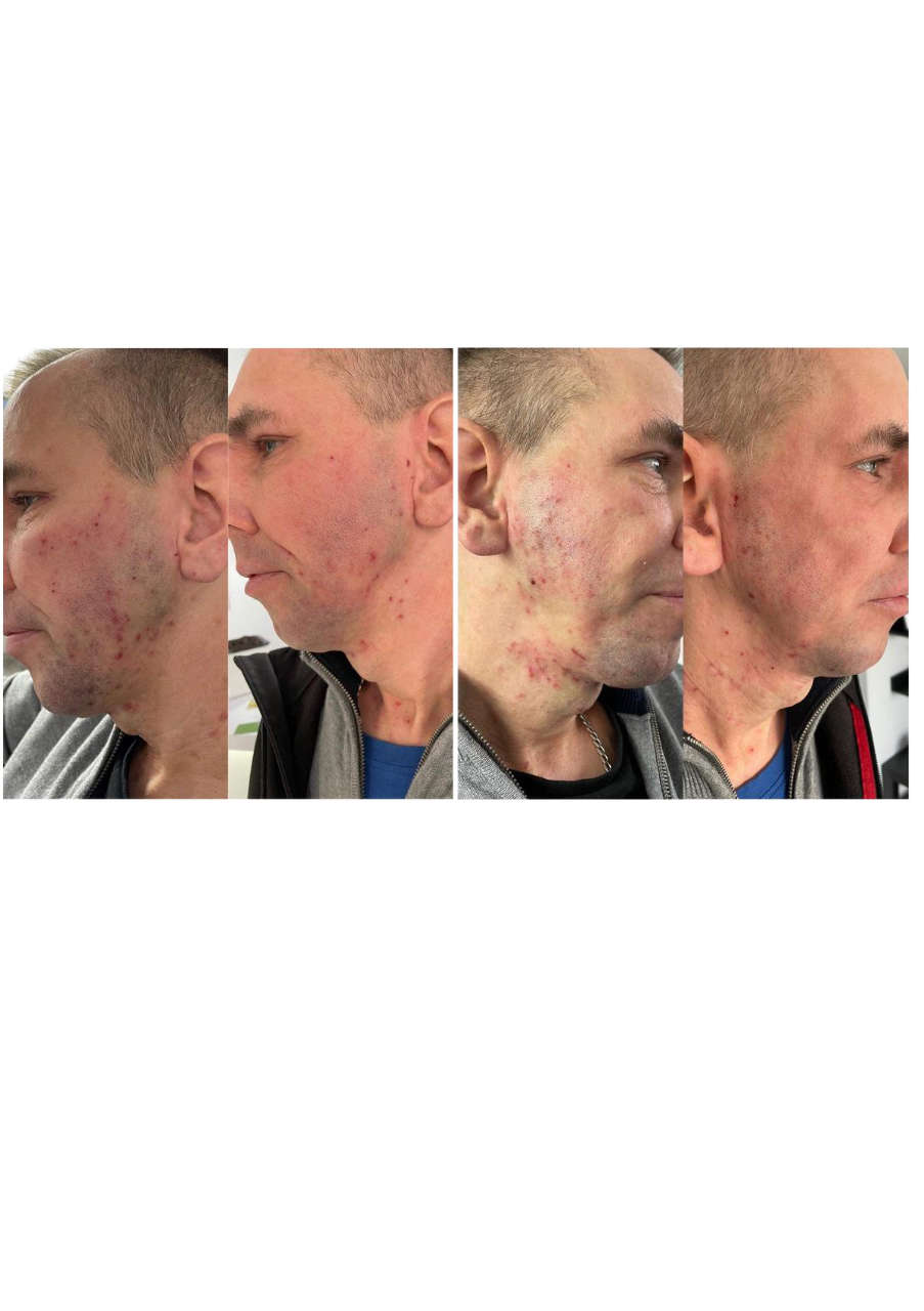 Strona 8 – Fototerapia Ogrody Spa