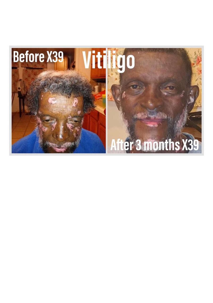 Strona 2 – Fototerapia Ogrody Spa