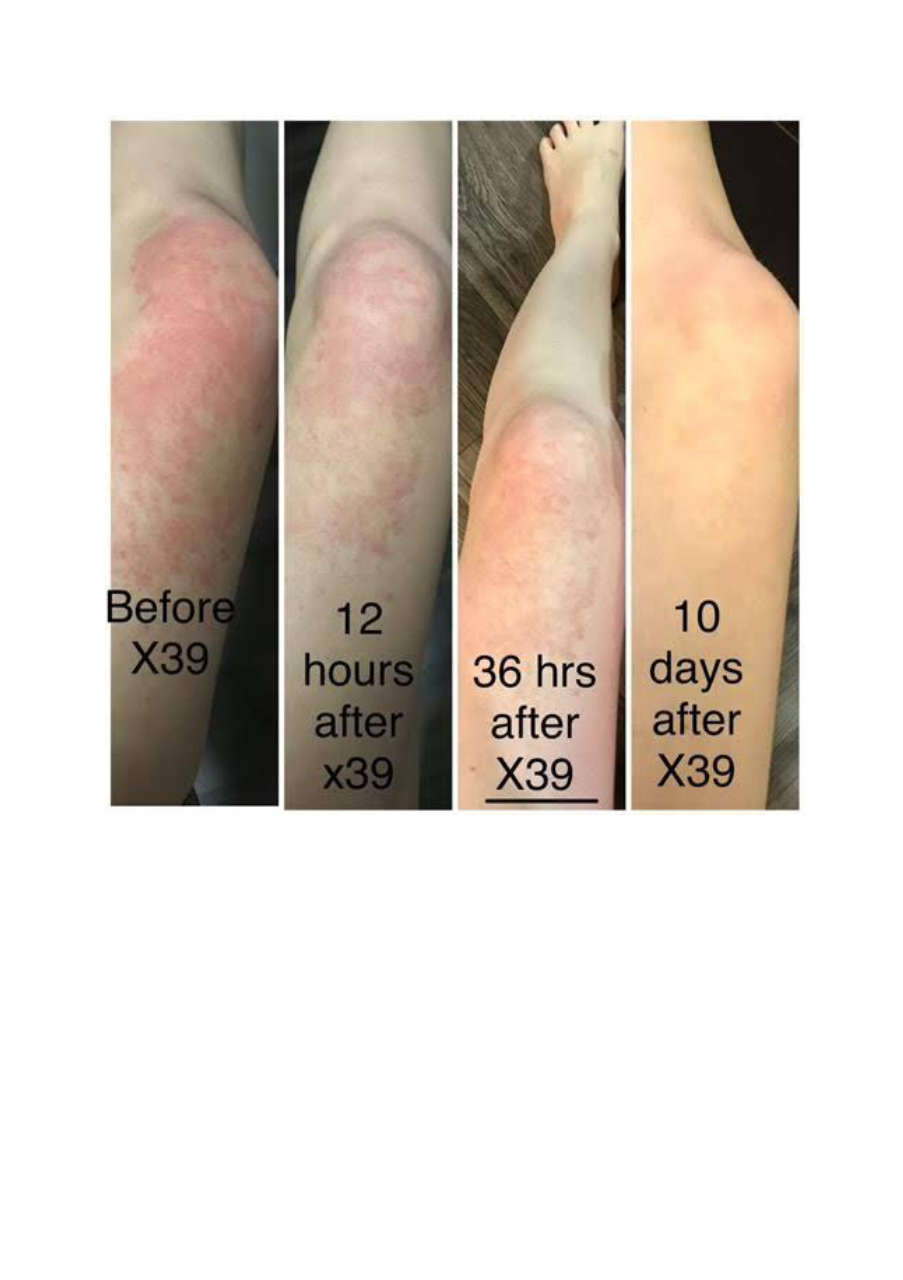 Strona 3 – Fototerapia Ogrody Spa