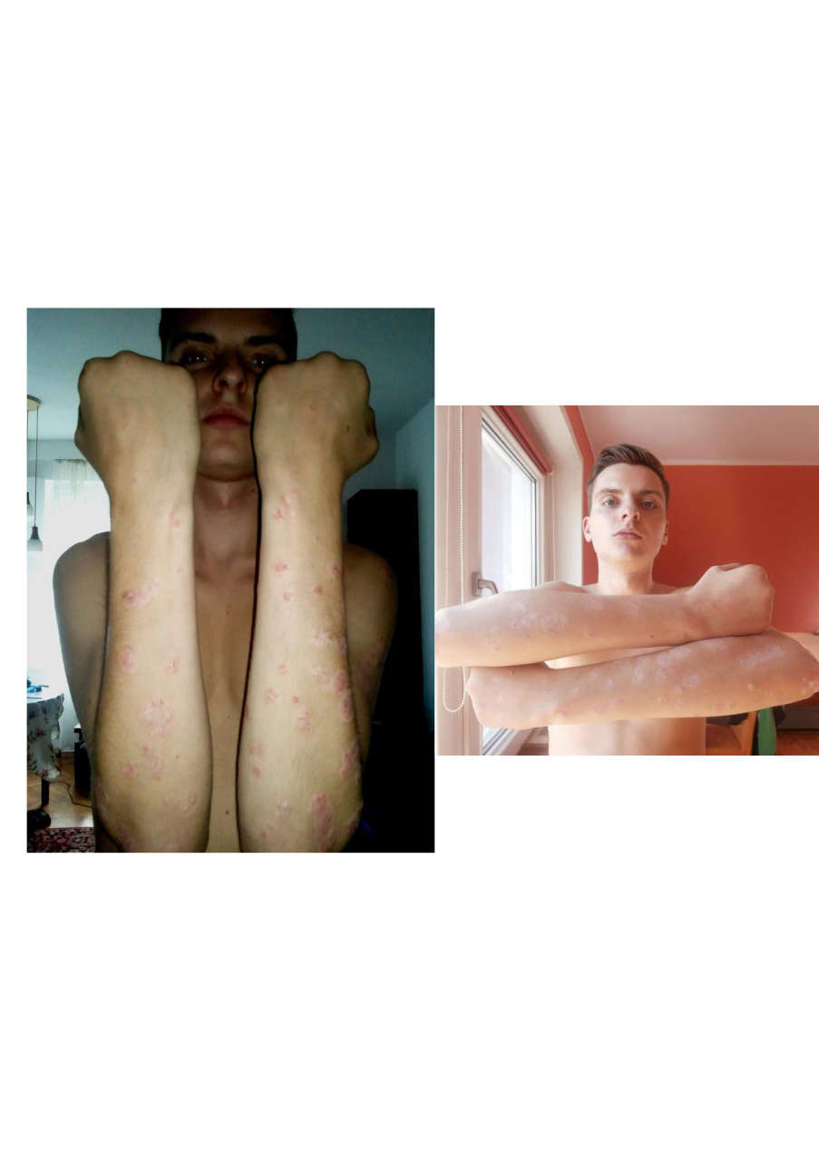 Strona 5 – Fototerapia Ogrody Spa