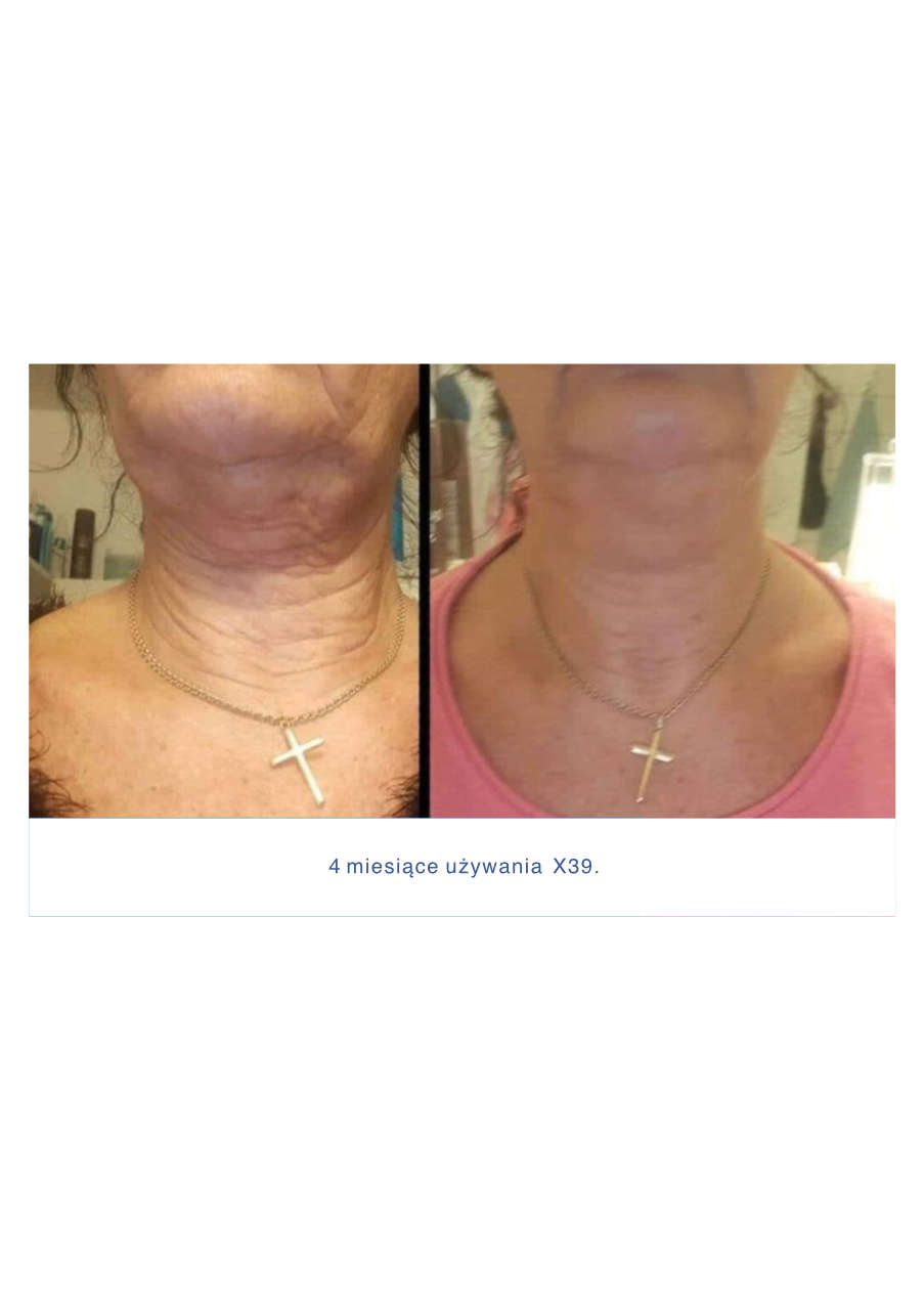 Strona 9 – Fototerapia Ogrody Spa