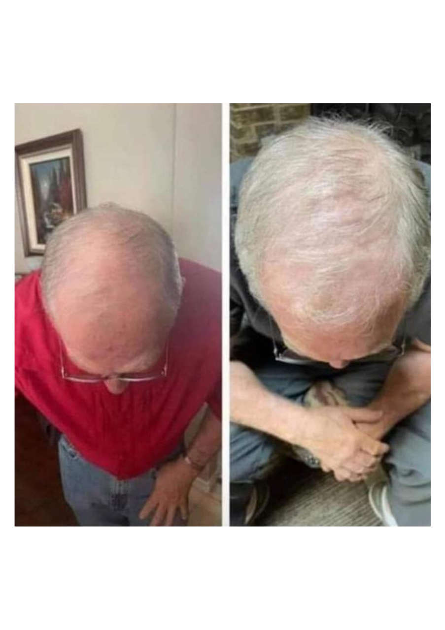 Strona 8 – Fototerapia Ogrody Spa