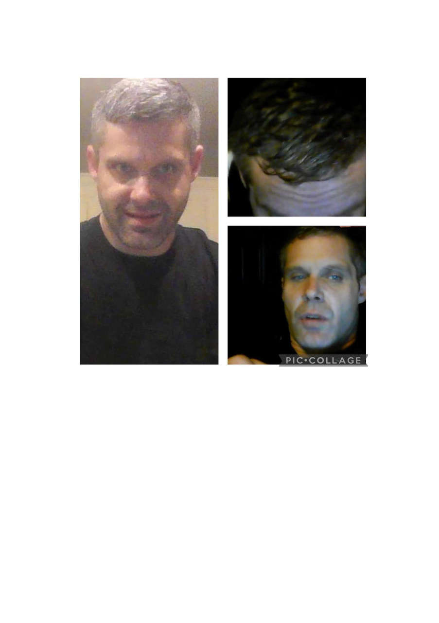 Strona 9 – Fototerapia Ogrody Spa